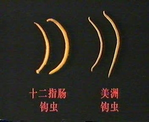 钩虫寄生虫成虫疥螨化学纤维镜下的球虫蠕形螨虱绦虫纤毛虫心丝虫