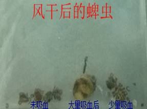 一例蜱虫叮咬的病例分析