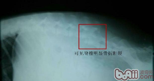 犬车祸后脊椎骨折的治疗