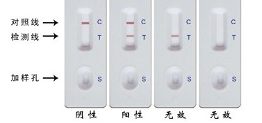 犬常见传染病之犬冠状病毒病