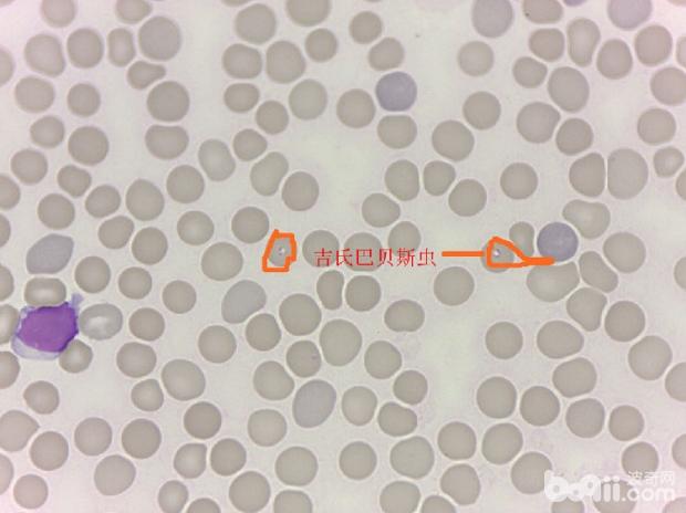 一例犬吉氏巴贝氏虫病例分析