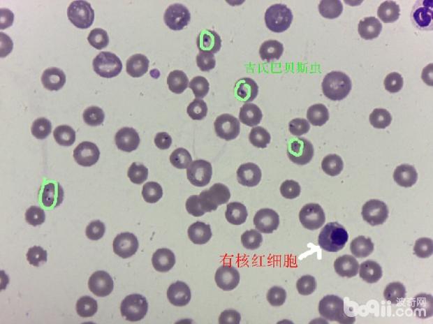 一例犬吉氏巴贝氏虫病例分析