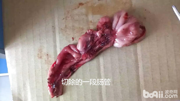 一例泰迪肠套叠的病例分析