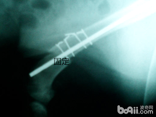 犬的肱骨骨折以及内固定